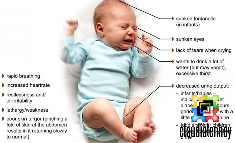 How to Tell If Baby is Dehydrated